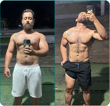 Resultado de paciente acompanhado por Filipe Alves — antes e depois 2