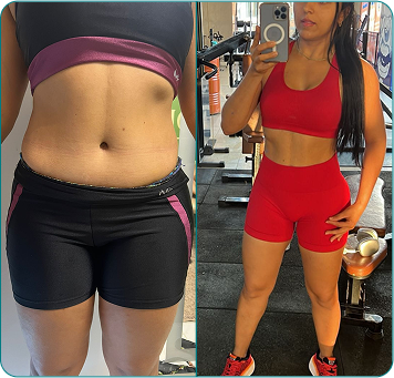 Resultado de paciente acompanhado por Filipe Alves — antes e depois 3