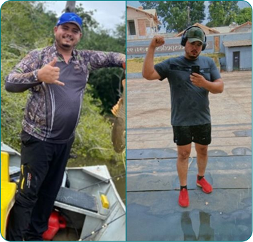 Resultado de paciente acompanhado por Filipe Alves — antes e depois 4